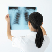 Lung Cancer  related image